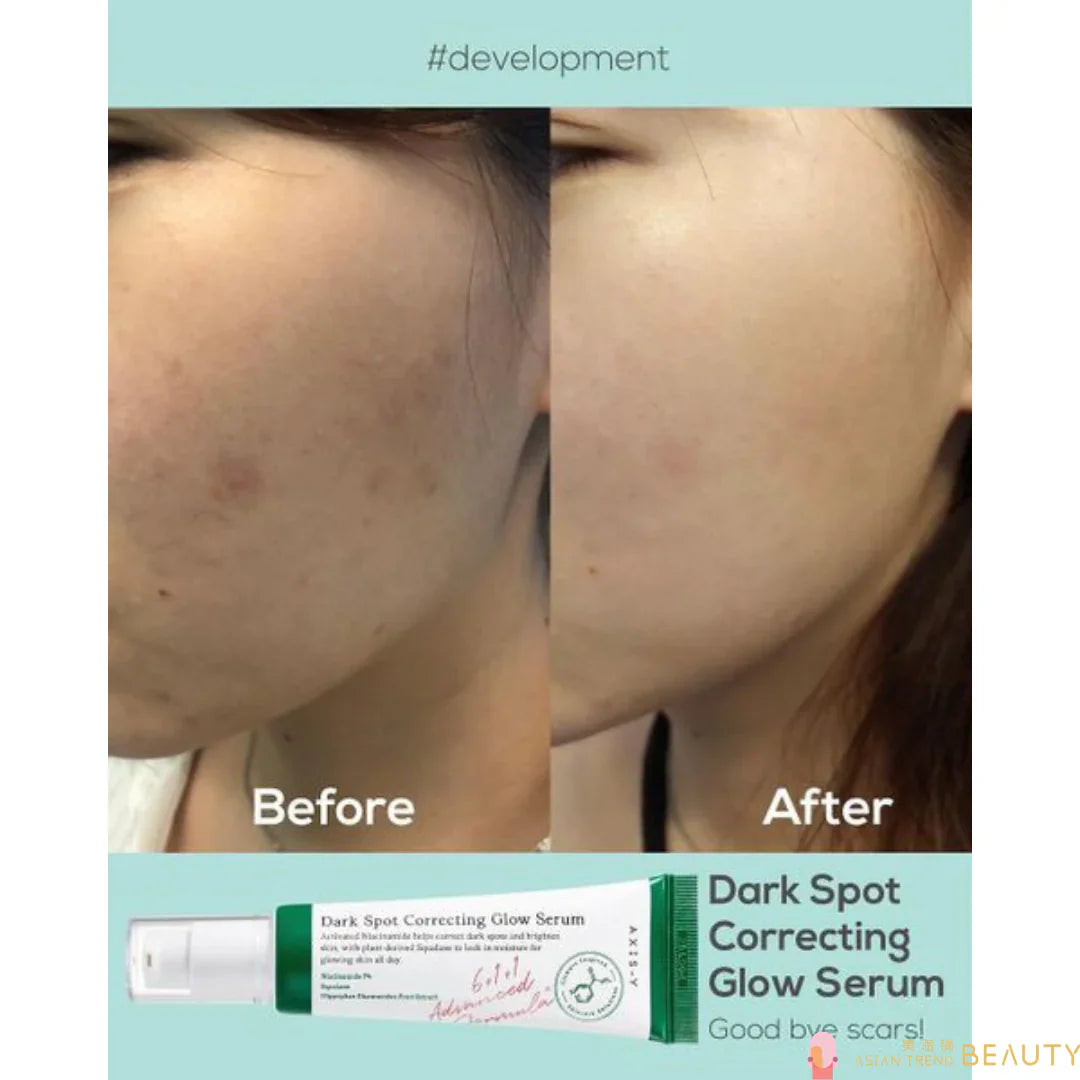 AXIS-Y Dark Spot Correcting Glow Serum 50ml - 5% Niacinamide Brightening Treatment